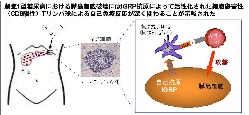 インスリンを服用する必要がありますか?