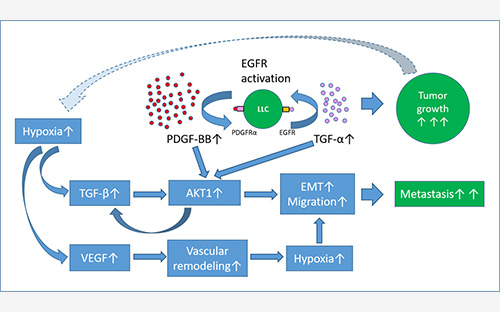 PDGFRαを介した細胞シグナルが固形癌の増悪と肺転移を調整していること